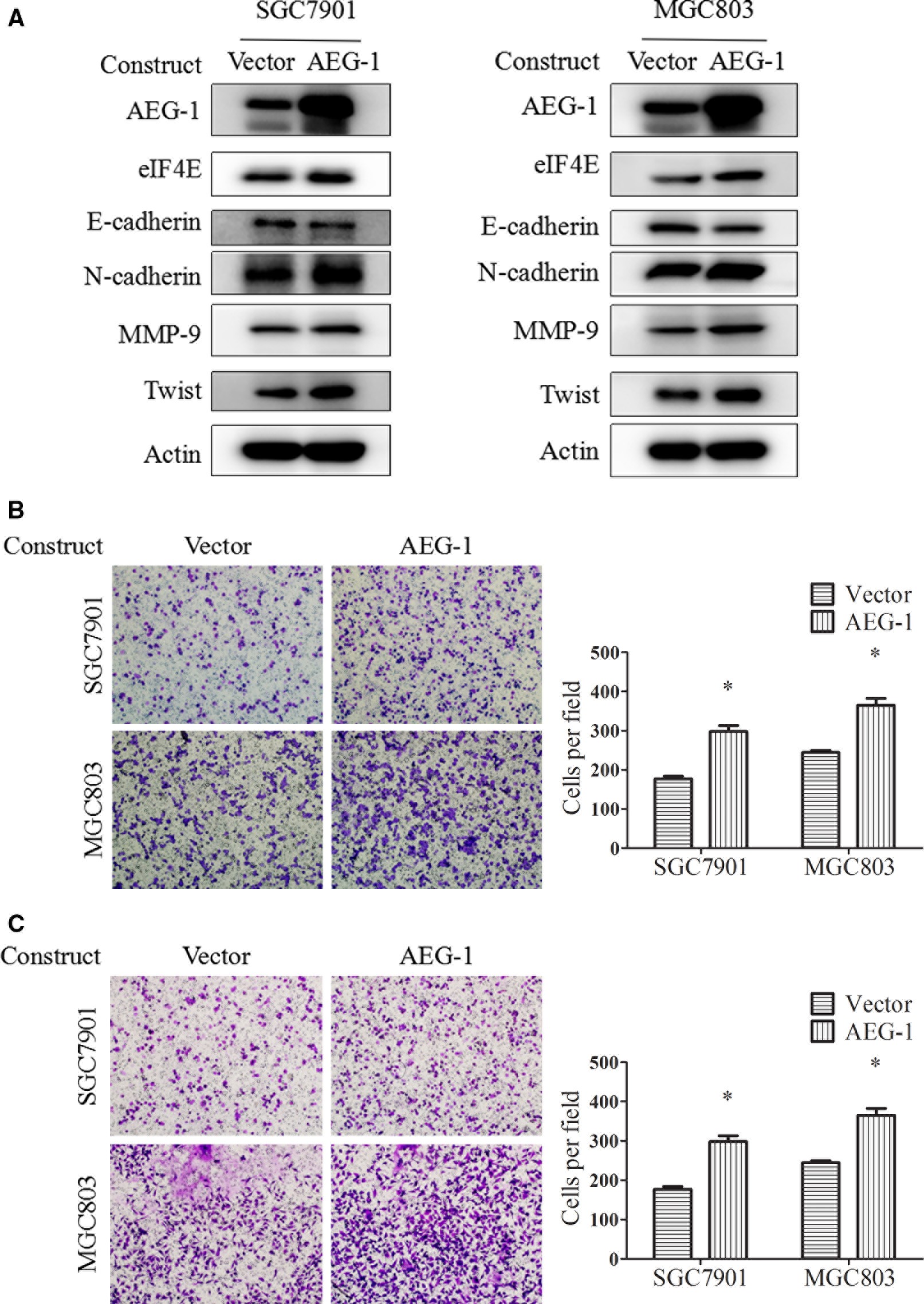 (PDF) AEG-1 induces gastric cancer metastasis by 